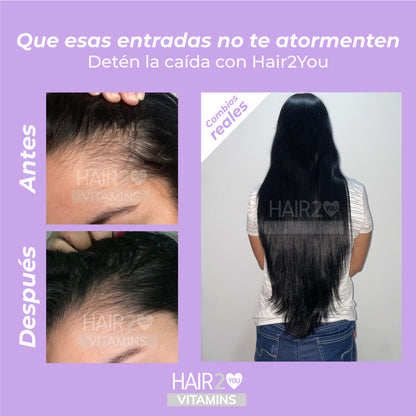 Loción capilar con Minoxidil + Shampoo Anti-Caída + Tratamiento Nutritivo - 40%