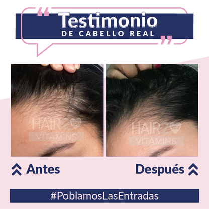 Loción capilar con Minoxidil + Shampoo Anti-Caída + Tratamiento Nutritivo - 40%