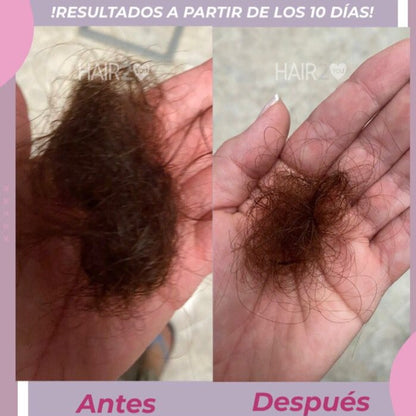 Loción capilar con Minoxidil + Shampoo Anti-Caída + Tratamiento Nutritivo - 40%